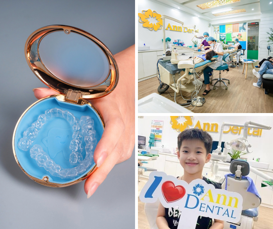 NHA KHOA THẨM MỸ ANN DENTAL